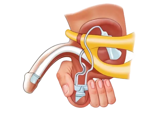 اضغط على الاسطوانة للتفريغ