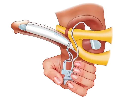 اضغط على المضخة للانتصاب